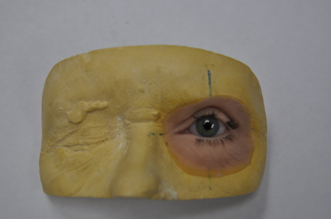 Photo of a sample of a facial prosthesis with a green eye sitting on a mold